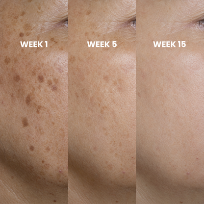 Peptide Microinfusion